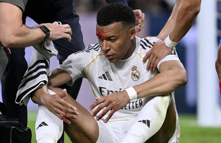 Розтин не перешкода: Мбаппе очікують у матчі Ліги чемпіонів